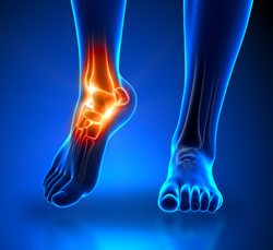 ankle-pain-blue_250pxwide_2.jpg