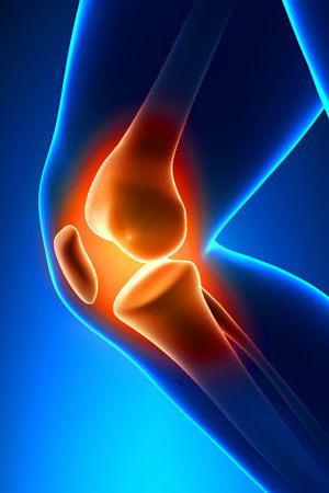knee-pain-blue_300x450.jpg