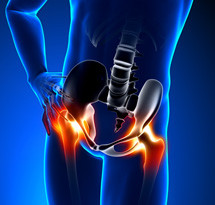 hip-pain-blue_215X205.jpg